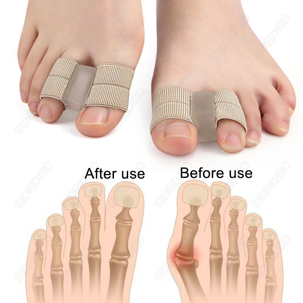 Bunion toe Corrector Orthotics - Women'S Shoes For Bunions avaliação e preço